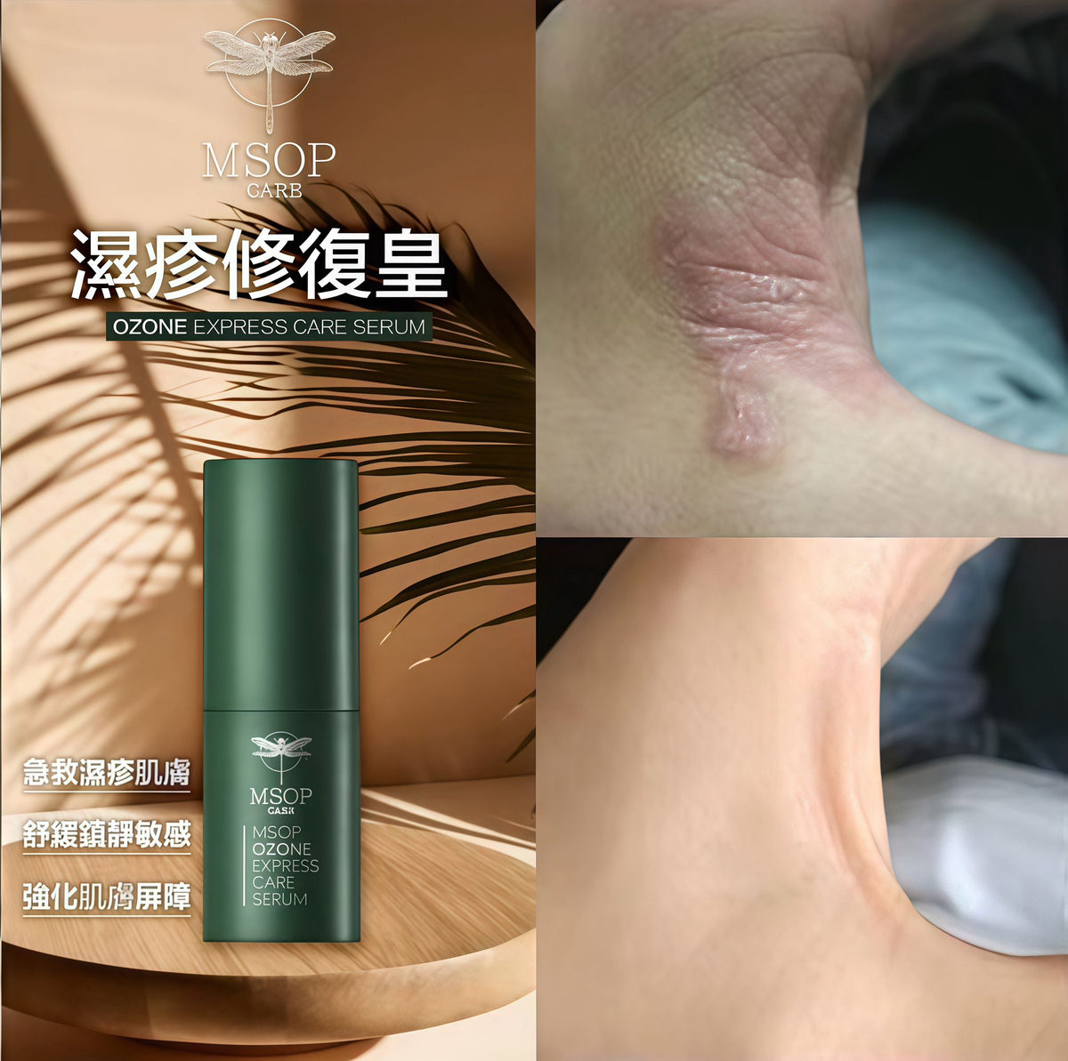 🌸MSOP濕疹修復皇 | 預訂約1-2星期 娉婷貿易公司 Exquisite Beauty Trading Company