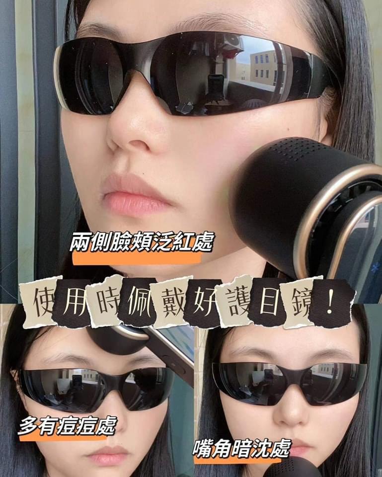 供應商現貨💫JOVS 追斑機 PLUS | 落單後約3-5個工作天寄出 娉婷貿易公司 Exquisite Beauty Trading Company