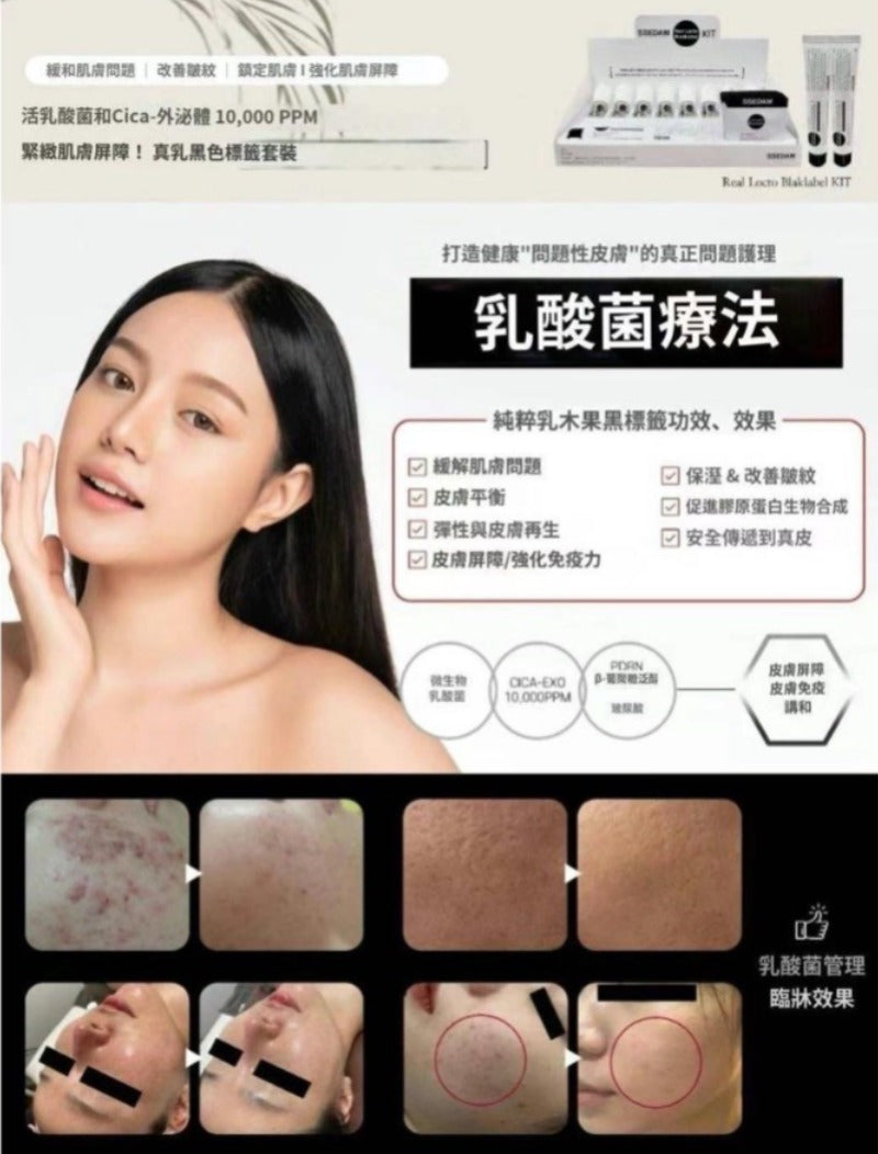 【24小時網站自助下單】現貨🌸韓國🇰🇷頂級醫美品牌 SSEDAM 乳酸菌積雪草外泌體療程套裝 1盒8次 | 落單後約3-5個工作天寄出 娉婷貿易公司 Exquisite Beauty Trading Company