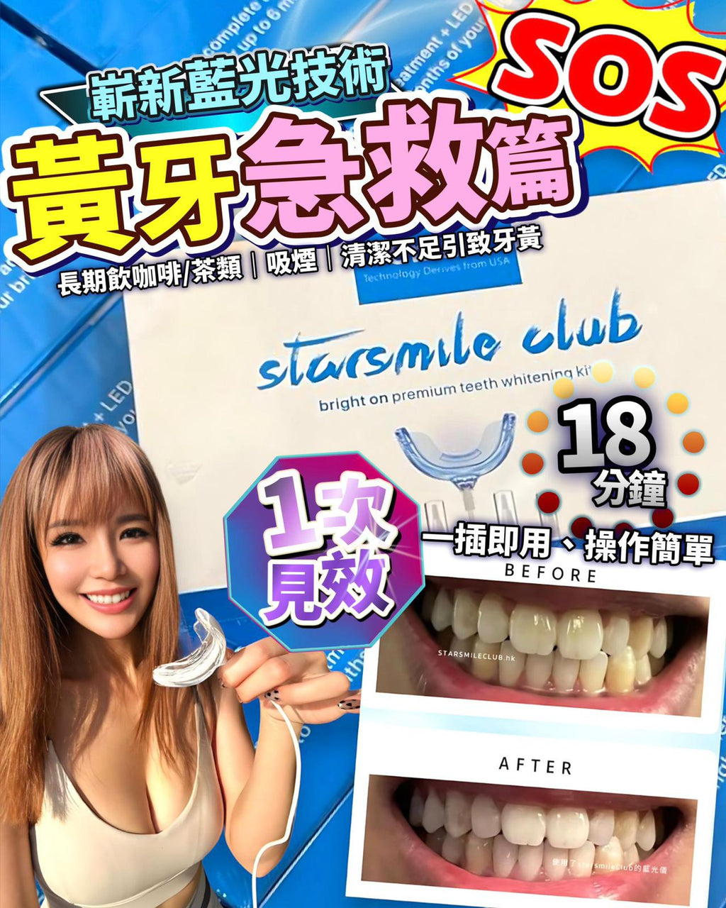 🌸StarSmileClub美國🇺🇸藍光美白牙齒機 | 預訂約2-3星期 娉婷貿易公司 Exquisite Beauty Trading Company