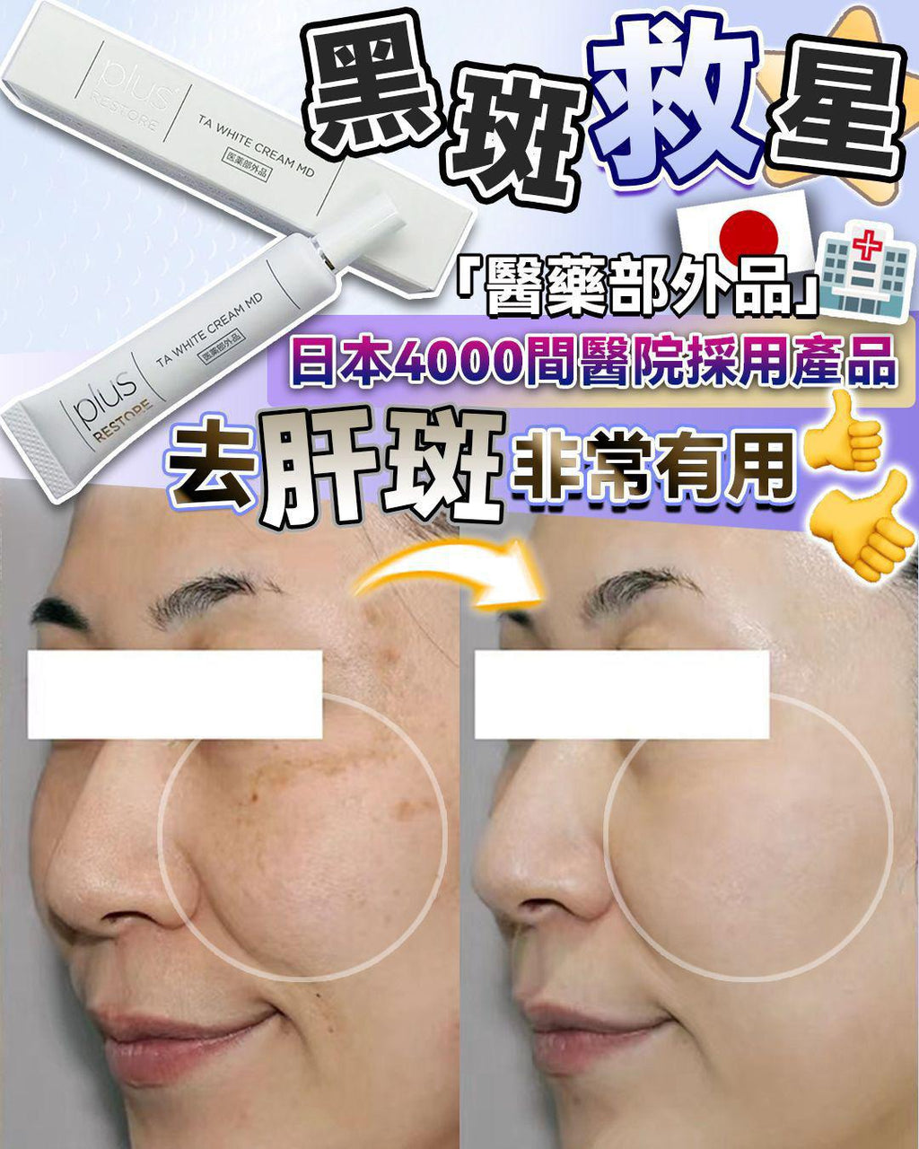 🌸日本 醫療級 黑斑救星 10g | 預訂約1星期 娉婷貿易公司 Exquisite Beauty Trading Company
