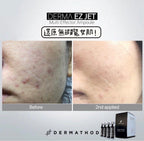 供應商現貨🌸DERMA EZ JET 魔女印精華療程套裝 Multi Effector Ampoule Treatment SET 一套4支精華+8片面膜 | 落單後約3-5個工作天寄出 娉婷貿易公司 Exquisite Beauty Trading Company