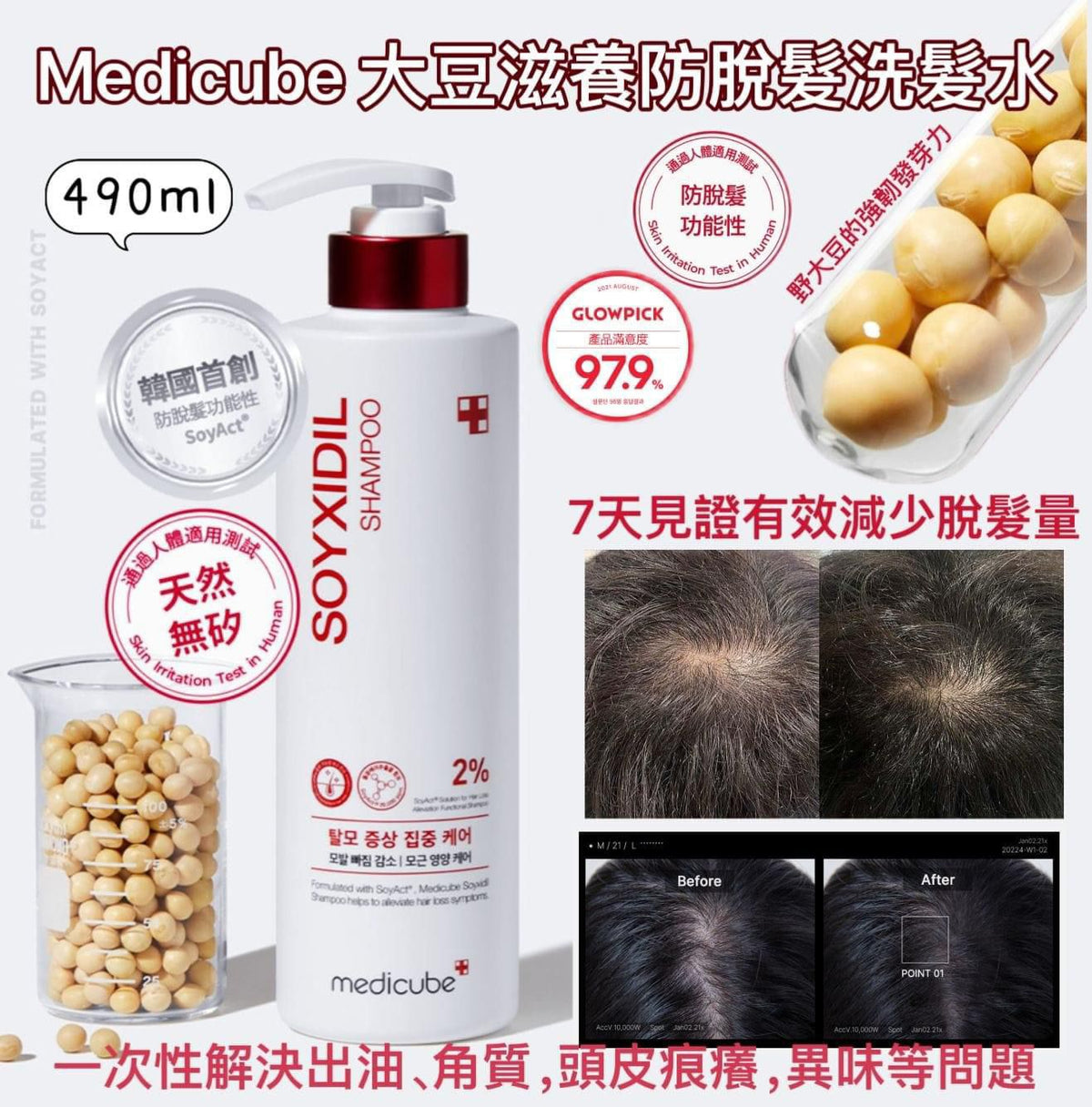 現貨🌸❤Medicube 大豆滋養防脫髮洗髮水 490ml | 落單後約3-5個工作天寄出 娉婷貿易公司 Exquisite Beauty Trading Company