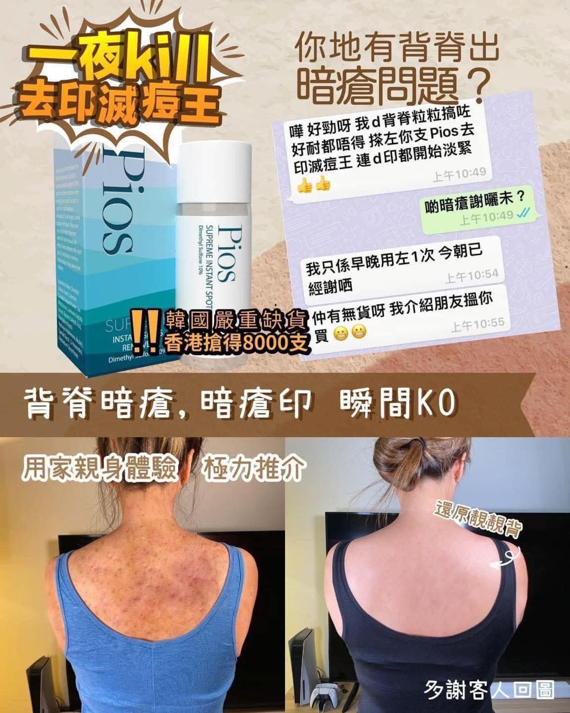 【24小時網站自助下單】現貨🌸Pios瞬時去痘淨膚精華 | 落單後約3-5個工作天寄出 娉婷貿易公司 Exquisite Beauty Trading Company