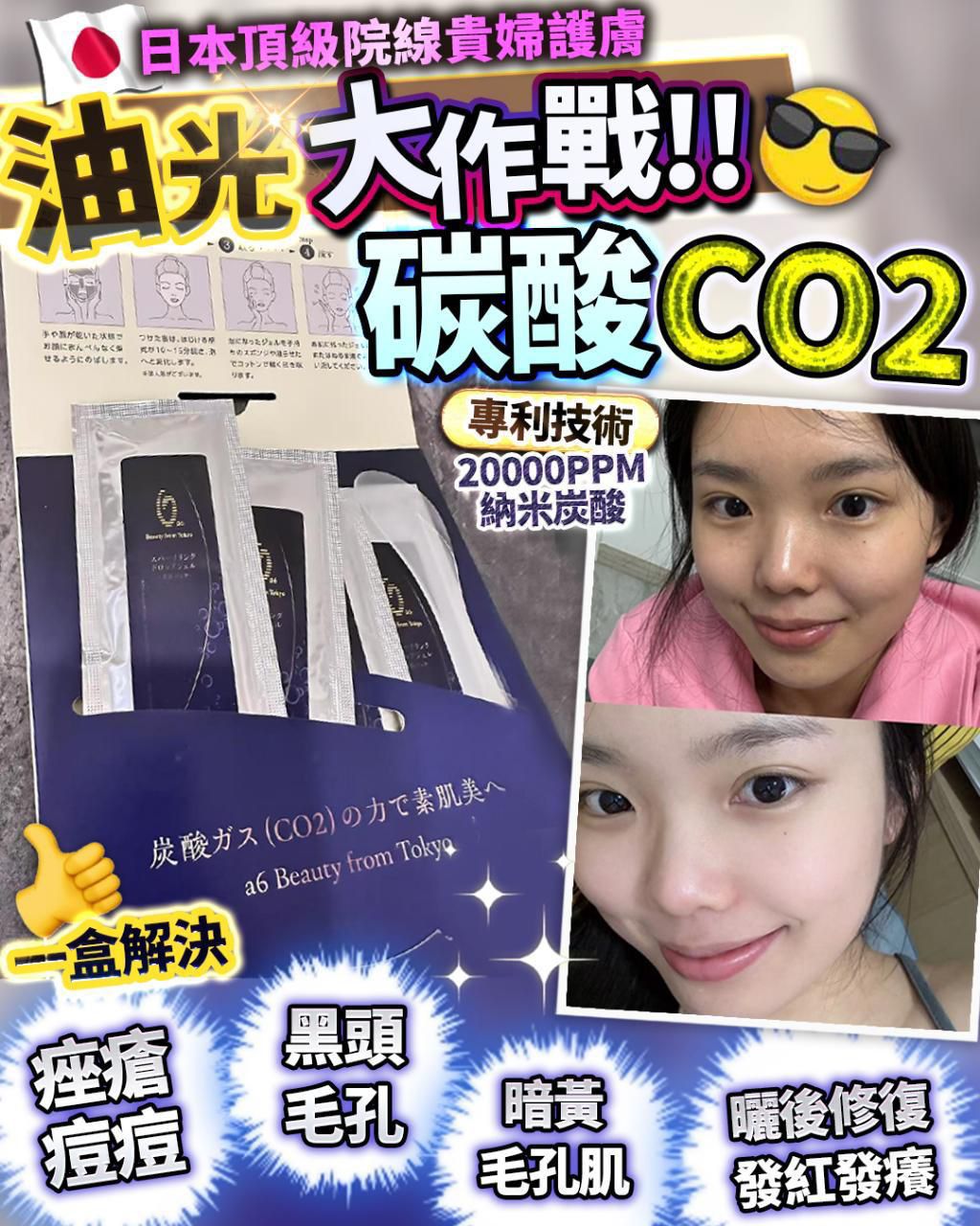 🌸重生碳酸面膜(藍色版)一盒4次 | 預訂約1-2星期 娉婷貿易公司 Exquisite Beauty Trading Company