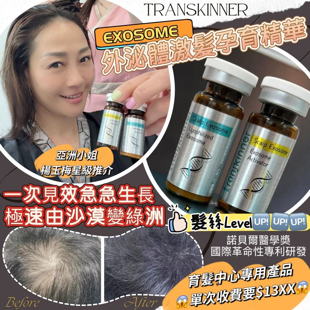 🌸Transkinner 生髮精華 | 預訂約2星期 娉婷貿易公司 Exquisite Beauty Trading Company