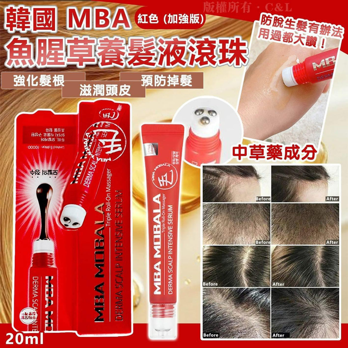 現貨🌸MBA 生髮滾珠紅色限量款（20ml） | 落單後約3-5個工作天寄出 娉婷貿易公司 Exquisite Beauty Trading Company