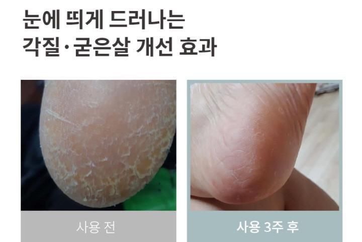 🌸🇰🇷韓國 hakyung茶樹精油護足滋潤棒 | 落單後約3-5個工作天寄出 娉婷貿易公司 Exquisite Beauty Trading Company