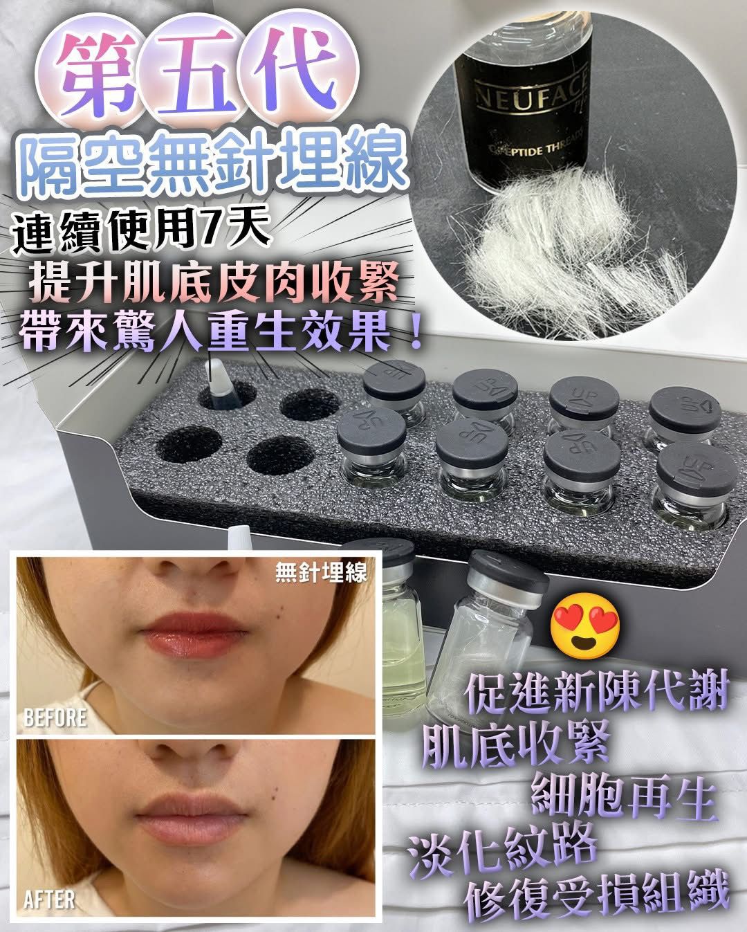 🌸Neuface Pro Demthread隔空無針埋線 | 預訂約1-2星期 娉婷貿易公司 Exquisite Beauty Trading Company