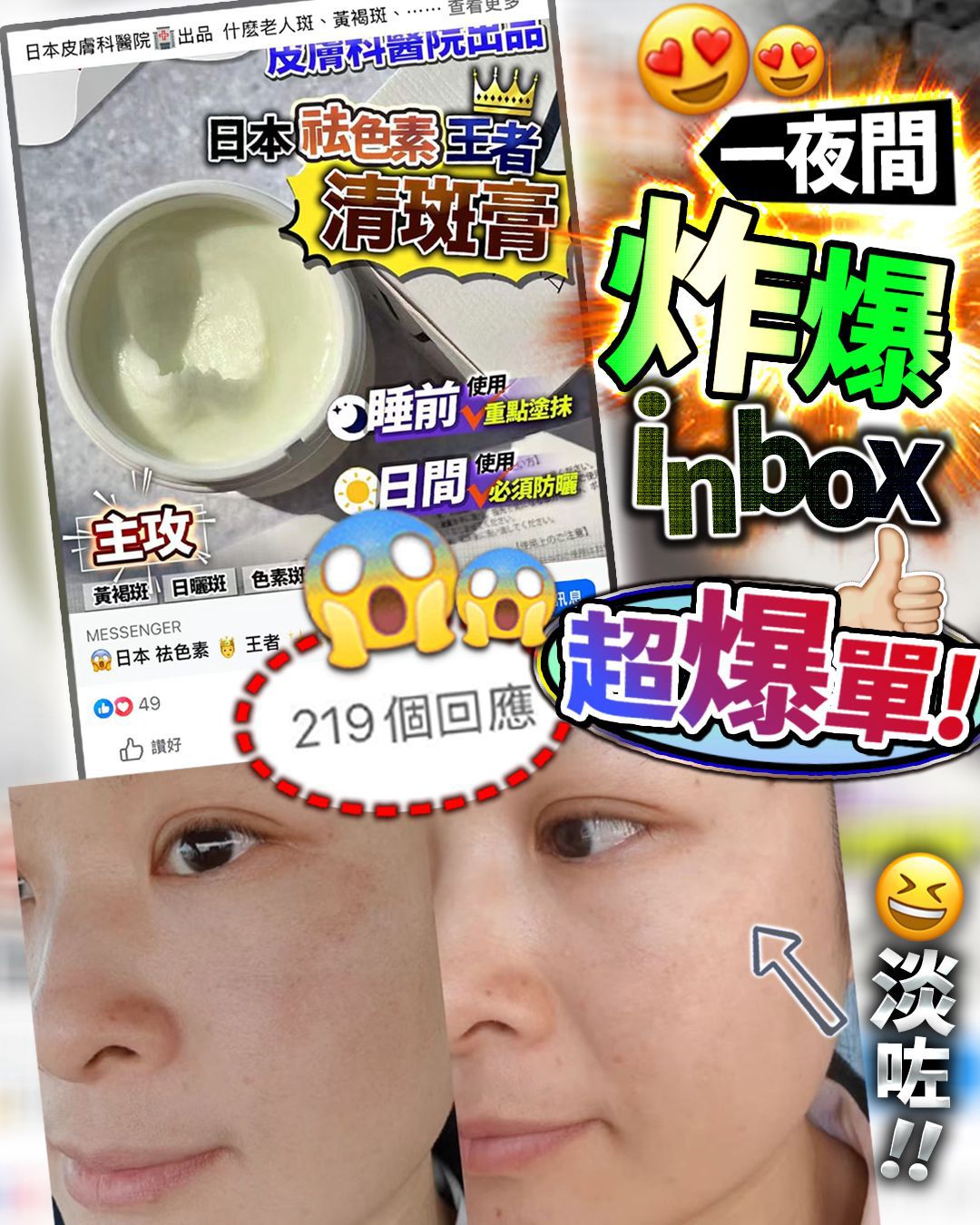 現貨🌸清斑膏 | 落單後約3-5個工作天寄出 娉婷貿易公司 Exquisite Beauty Trading Company