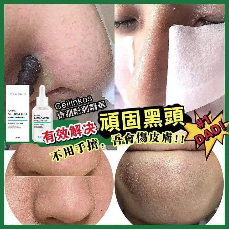 🌸Cellinkos 奇蹟粉刺精華 | 預訂約2星期 娉婷貿易公司 Exquisite Beauty Trading Company