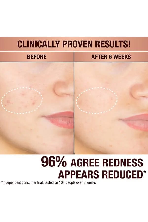 售完即止🌸✨💨快閃預訂💨✨免稅正品 Charlotte Tilbury CT 暗斑透亮精華30ml | 預訂約2-3星期 娉婷貿易公司 Exquisite Beauty Trading Company
