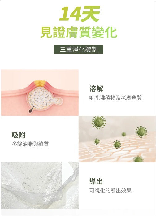 【24小時網站自助下單】現貨🌸EIOM 祛痘淨膚面膜（Trouble Patch Mask）1盒4片 | 落單後約3-5個工作天寄出 娉婷貿易公司 Exquisite Beauty Trading Company