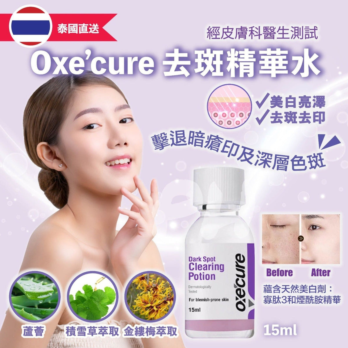 【24小時網站自助下單】現貨🌸Oxe’cure 💞淡斑去印精華水 15ml | 落單後約5-7個工作天寄出 娉婷貿易公司 Exquisite Beauty Trading Company