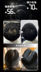 【24小時網站自助下單】售完即止🌸香港行貨 台灣Relove 髮量爆澎套裝：黑泌肽豐盈洗髮精+養髮液 | 預訂約2-3星期 娉婷貿易公司 Exquisite Beauty Trading Company