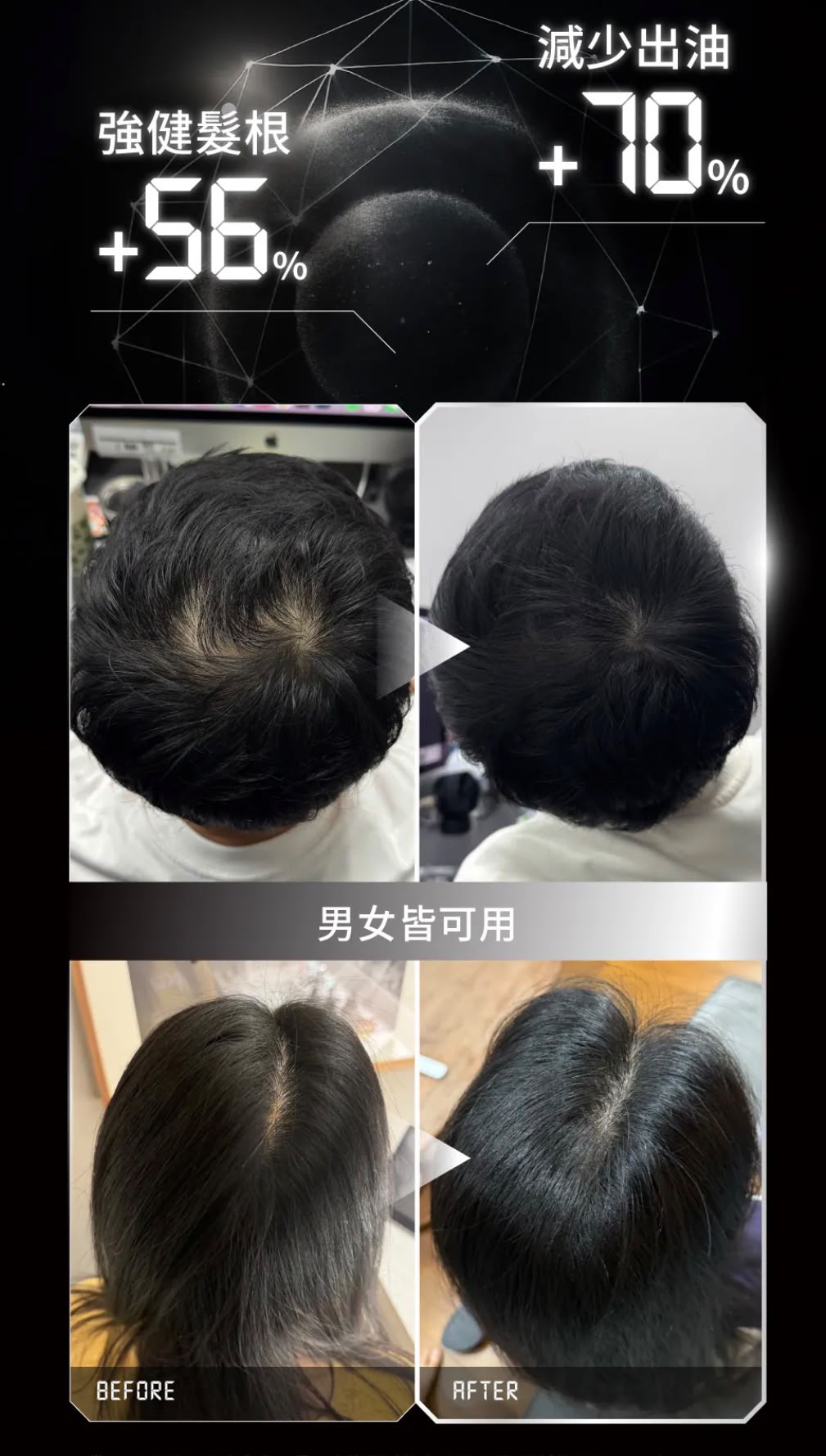【24小時網站自助下單】售完即止🌸香港行貨 台灣Relove 髮量爆澎套裝：黑泌肽豐盈洗髮精+養髮液 | 預訂約2-3星期 娉婷貿易公司 Exquisite Beauty Trading Company