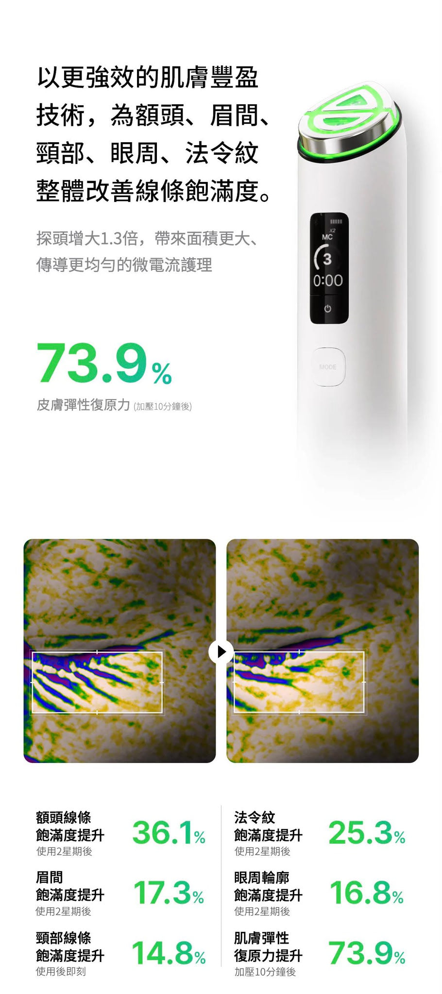 【24小時網站自助下單】現貨🌸Medicube [9in1多功能升級] AGE-R Booster Pro X2 | 落單後約3-5個工作天寄出 娉婷貿易公司 Exquisite Beauty Trading Company