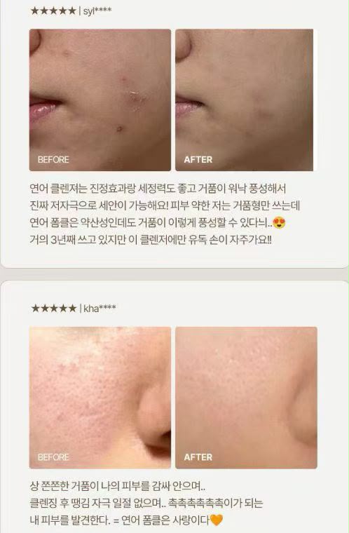 【24小時網站自助下單】2026年7月25日截🌸韓國🇰🇷最新出🆕Olive Young 常駐熱銷榜 HEVEBLUE 專業修護王牌潔面200ml | 預訂約3-4星期 娉婷貿易公司 Exquisite Beauty Trading Company
