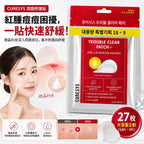 現貨 | CURESYS Trouble Clear Patch+ 痘痘修護貼 娉婷貿易公司 Exquisite Beauty Trading Company