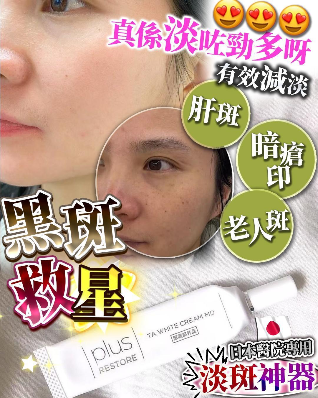 🌸日本 醫療級 黑斑救星 10g | 預訂約1星期 娉婷貿易公司 Exquisite Beauty Trading Company