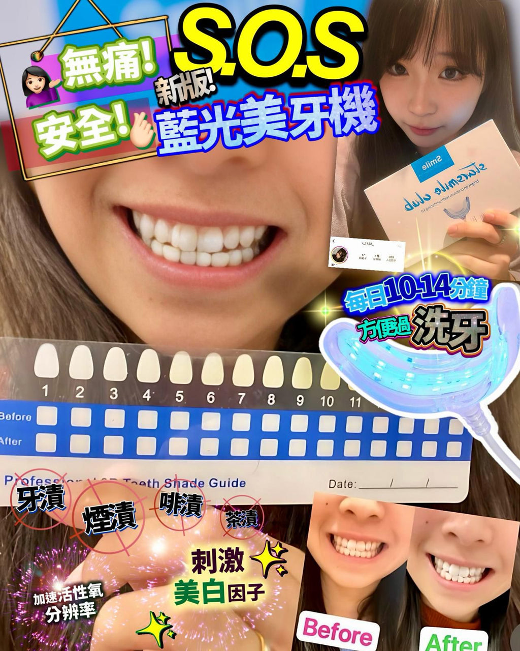 🌸StarSmileClub美國🇺🇸藍光美白牙齒機 | 預訂約2-3星期 娉婷貿易公司 Exquisite Beauty Trading Company