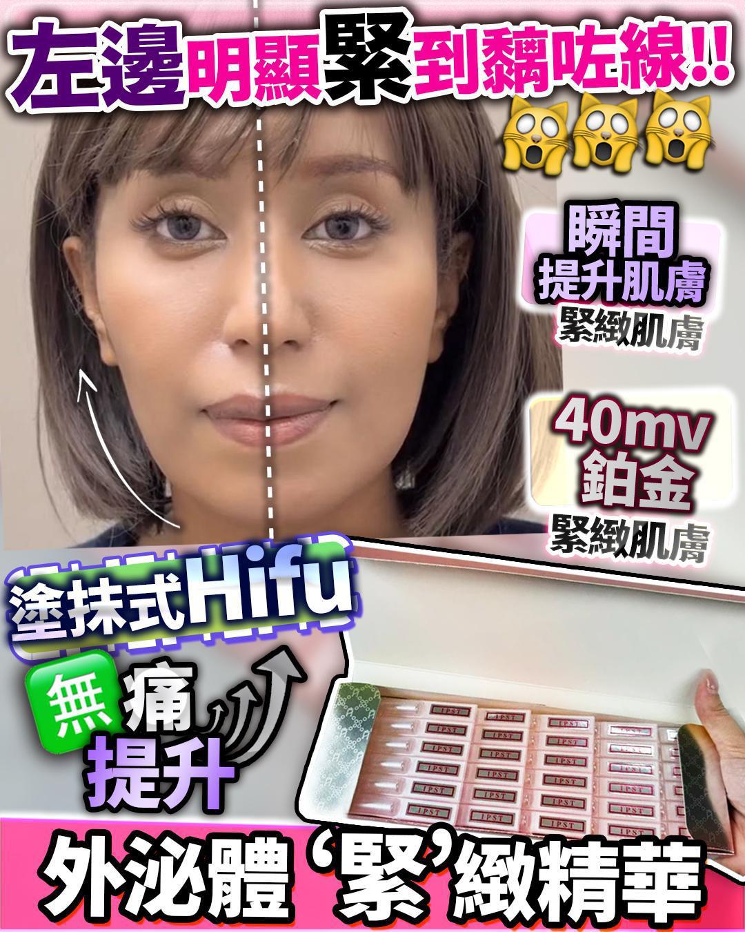 🌸外泌體收緊精華 一盒30支 | 預訂約1-2星期 娉婷貿易公司 Exquisite Beauty Trading Company