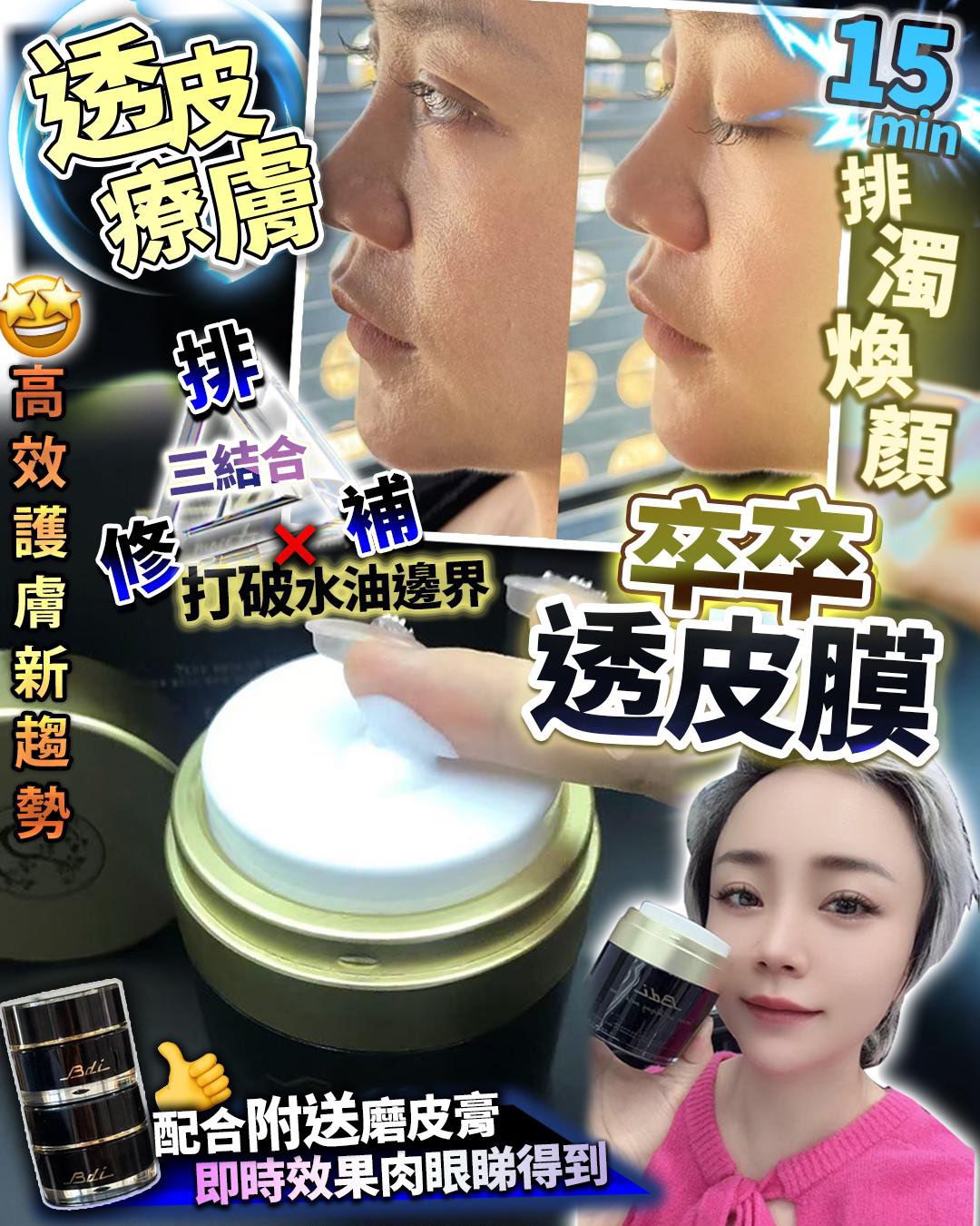 【24小時網站自助下單】🌸卒黃氣透皮膜30g 送磨皮sample(2個) | 預訂約2-3星期 娉婷貿易公司 Exquisite Beauty Trading Company