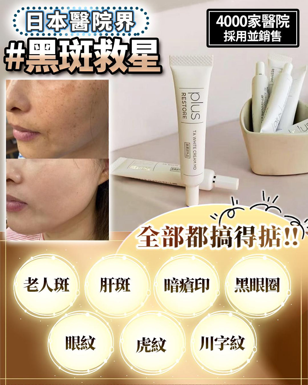 🌸日本 醫療級 黑斑救星 10g | 預訂約1星期 娉婷貿易公司 Exquisite Beauty Trading Company